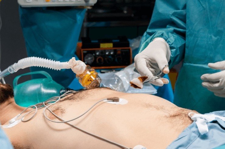 Best Cytoreductive Surgeon in Gurugram