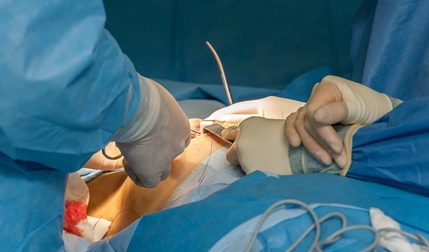 Best Breast Cancer Surgeon in Gurgaon