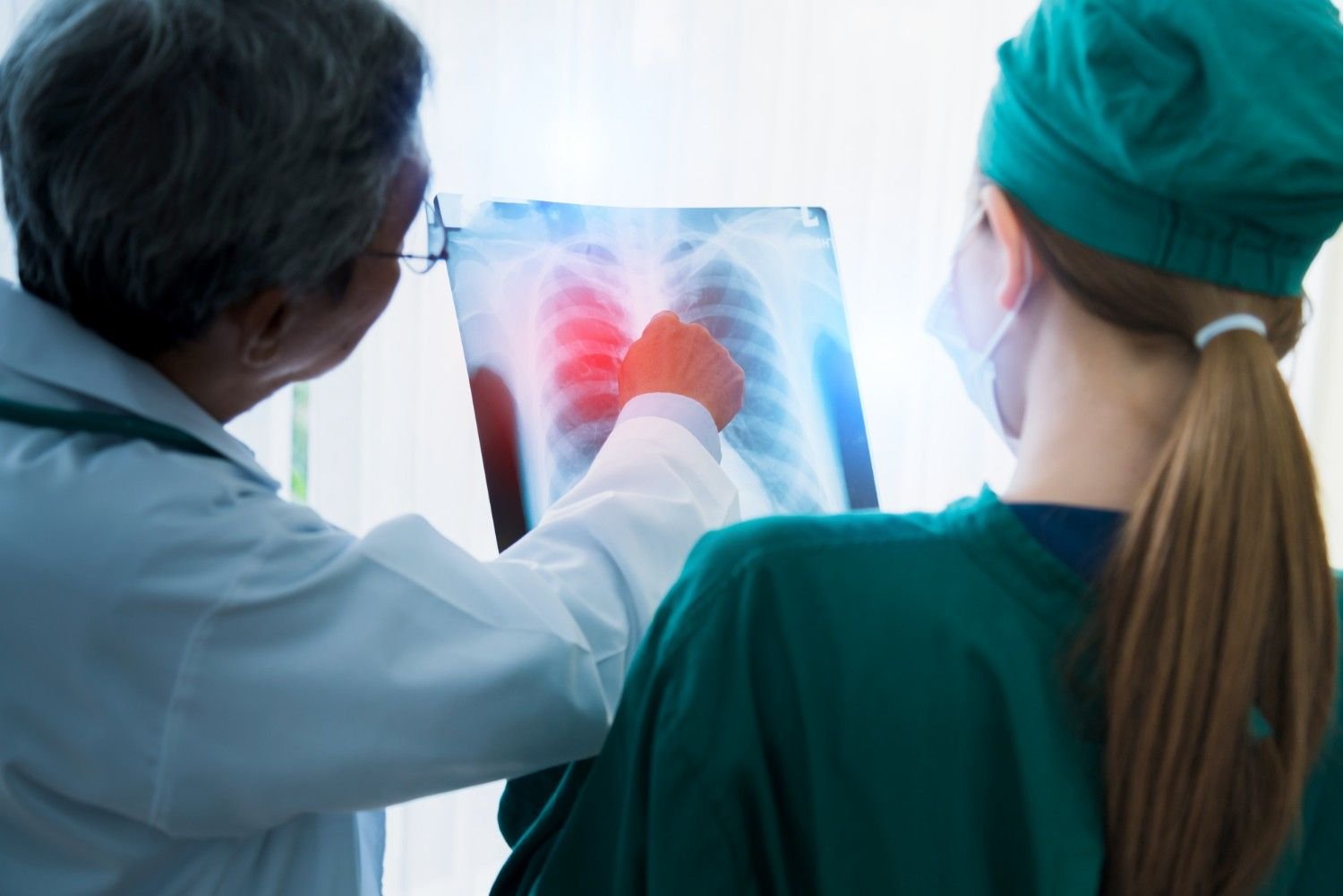 Lung Cancer Treatment in Gurugram